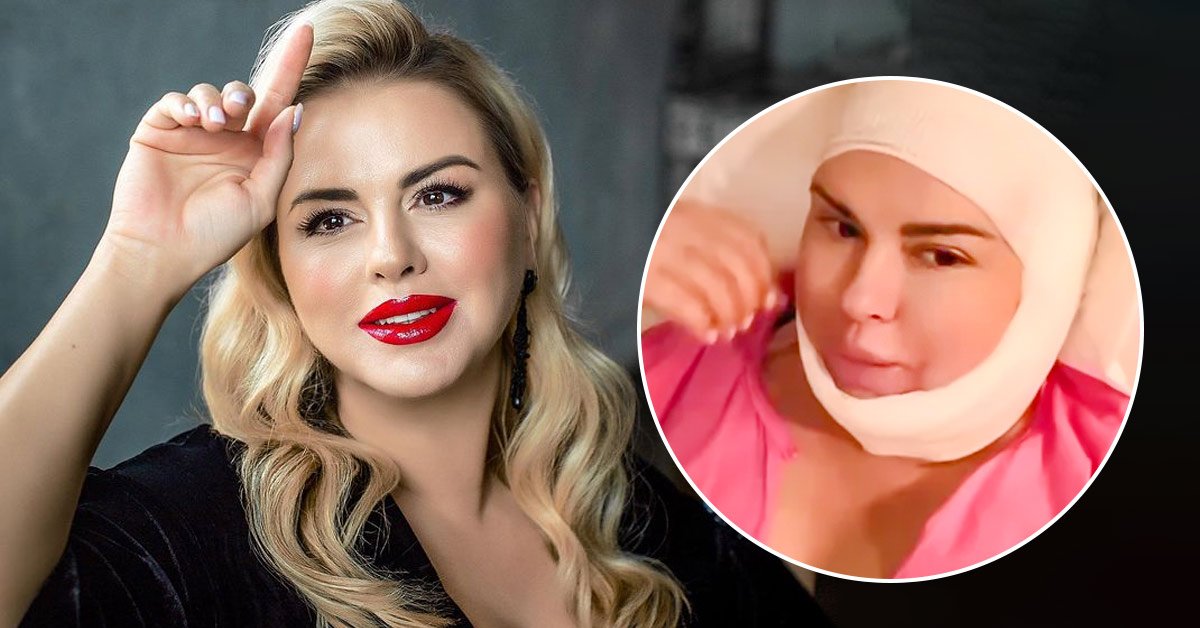 анна семенович сделала липосакцию