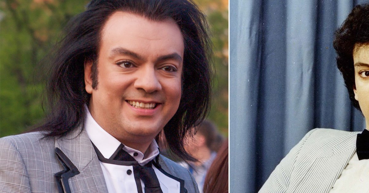 артисты которые сделали пластику