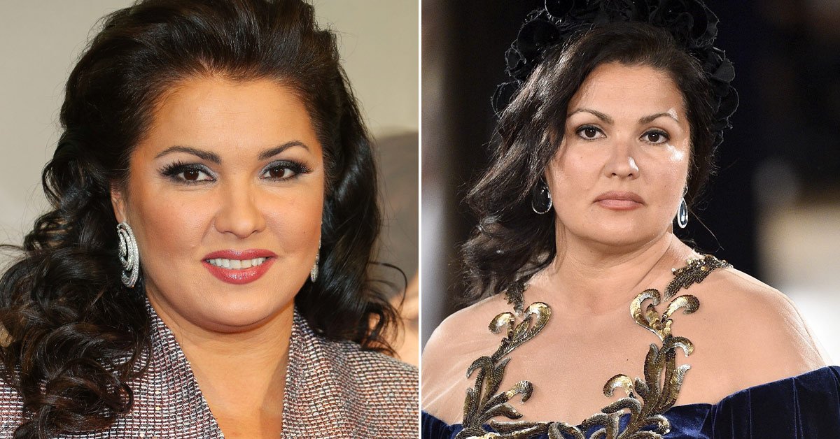 история анны нетребко