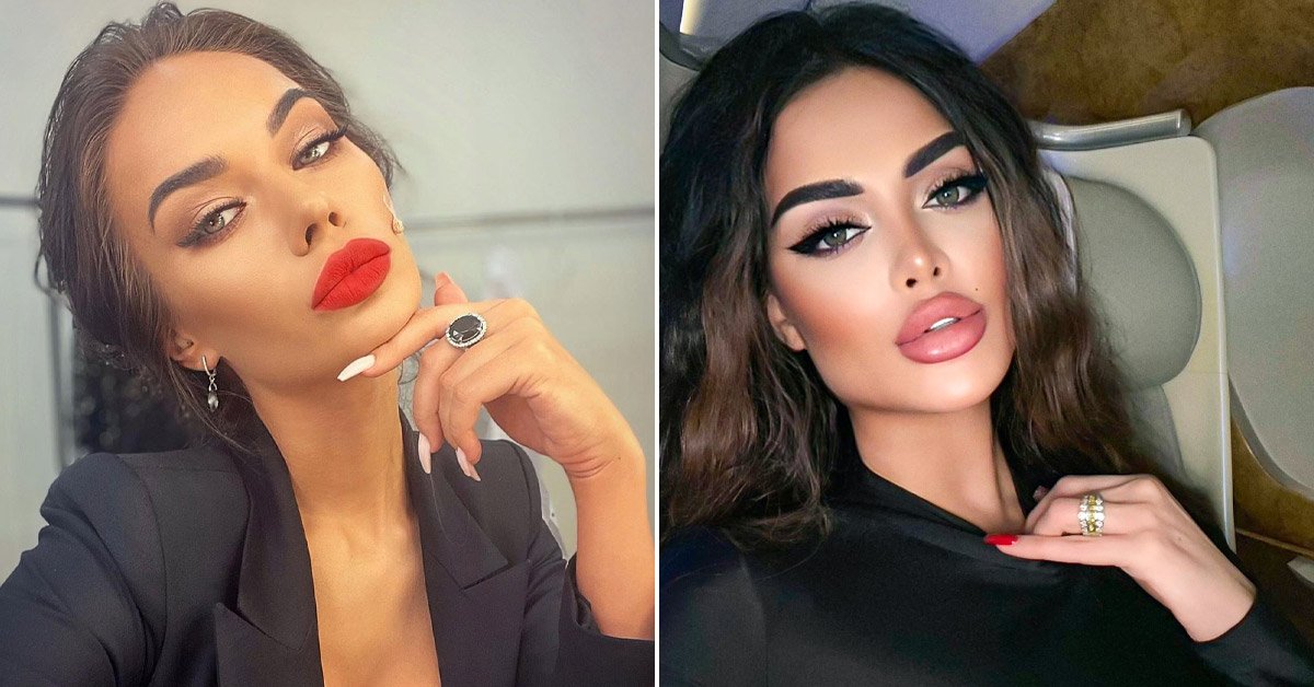 молодые звезды с пластикой