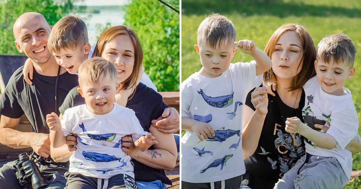 рождение необычной двойни