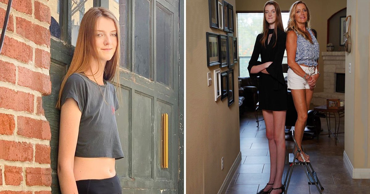 самые длинные ноги в мире